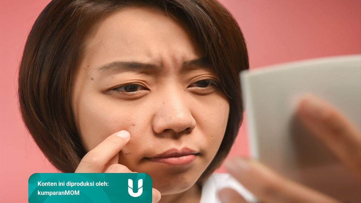 Muncul Banyak Tahi Lalat Saat Hamil Normal Enggak Ya Kumparan Com