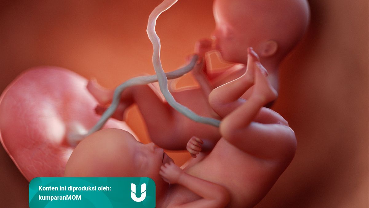 Foto Perkembangan Bayi Kembar Di Dalam Rahim Ibu Hamil Kumparan Com