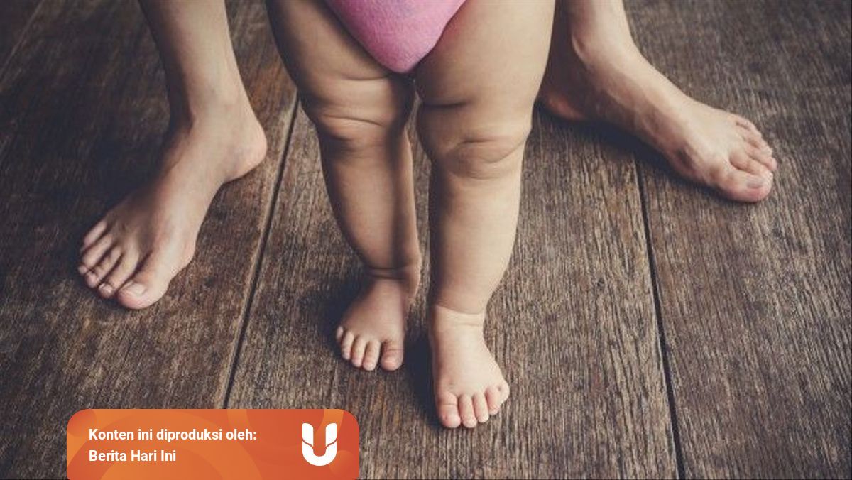 Memahami Kondisi Kaki X Pada Anak Dan Penyebabnya Kumparan Com
