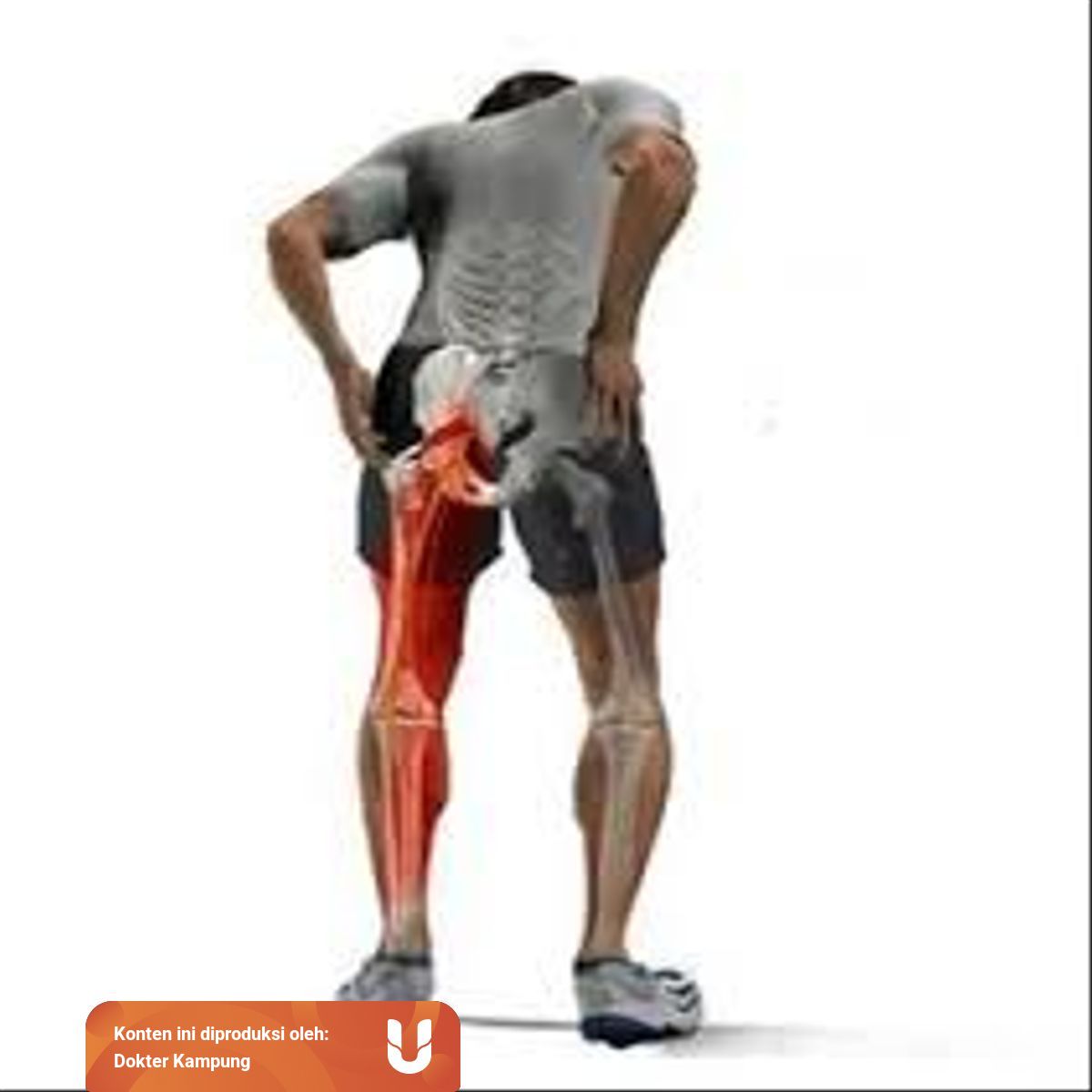 Obat Sciatica Nyeri Panggul Kumparan Com