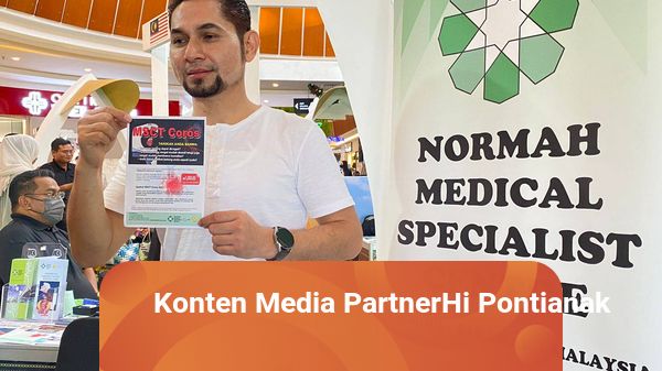 RS Normah Kuching Beri Diskon 50 Persen untuk Warga Kalbar Periksa Jantung