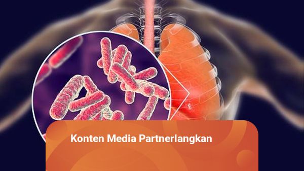 Sebanyak 2.821 Warga Terjangkit TBC, Dinkes Padang Siapkan Tim Penanganan