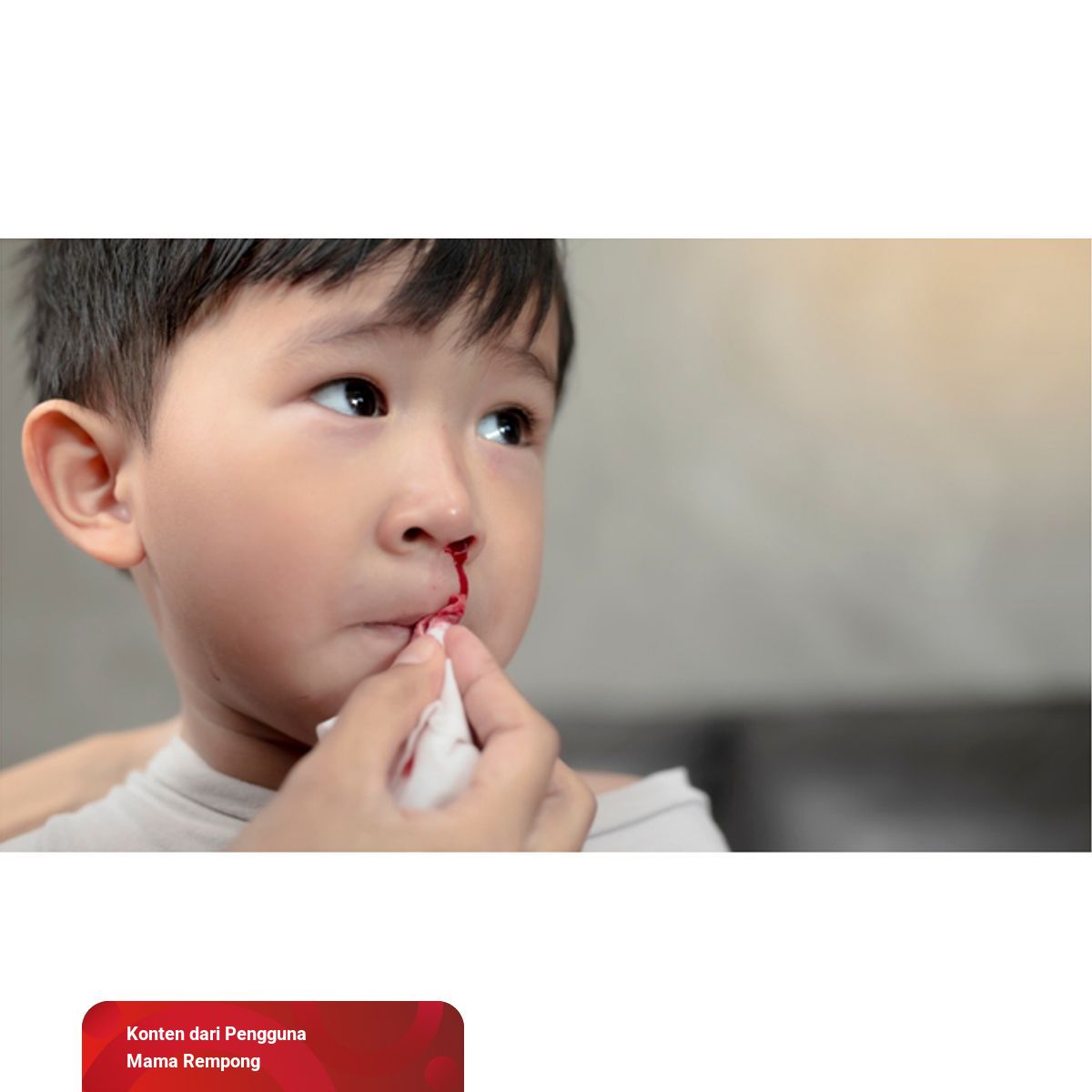 Cara Mengatasi Anak Mimisan | kumparan.com