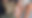 Alfi Azka (3), balita laki-laki asal Dusun/Desa Tulung, Kecamatan Saradan, Kabupaten Madiun mengidap penyakit kulit langka bernama Epidermolisis Bulosa. Foto: Dok. Istimewa