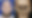 Aaron James, 46 tahun, menjalani prosedur perintis ini setelah cedera listrik bertegangan tinggi yang menyebabkan kerusakan parah pada wajahnya. Foto: Dok. JAMA / Ceradini, D.J., et al