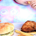 Obesitas Anak