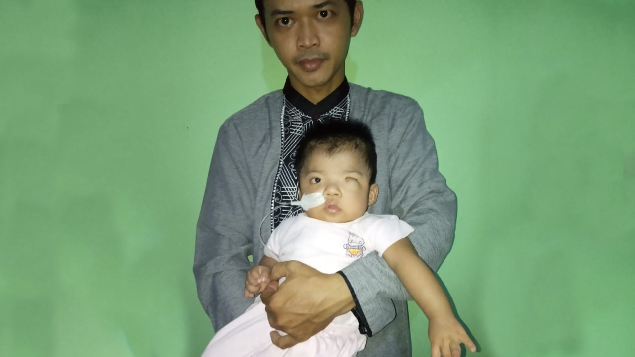 Achmad Farhan, bayi pengidap charge syndrom