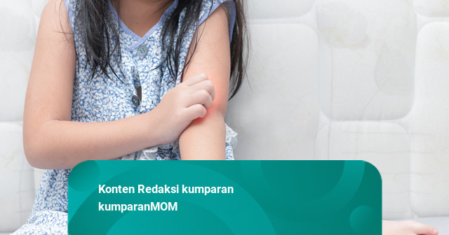 Kenapa Kasus Alergi pada Anak Semakin Banyak? Ini Penjelasan Dokter