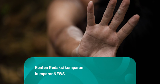 Bocah 7 Tahun di Dairi Diduga Disiksa Bibinya, Alami Luka di Wajah hingga Kaki