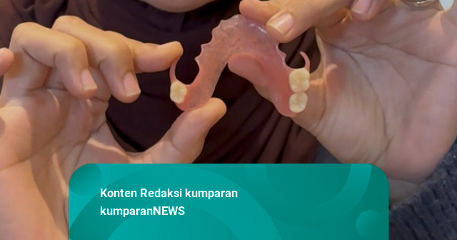 Ramai Tambal Gigi Sendiri, Pasien Alami Bengkak hingga Infeksi