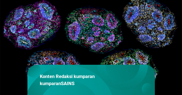 Otak Mini dari Sel Manusia Hidup 6 Tahun di Lab: Punya Ingatan & Menua