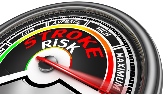 Resiko terkena stroke bisa dikurangi (Foto: Thinkstock)