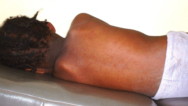 Bocah Afrika. (Foto: Wikimedia Commons)