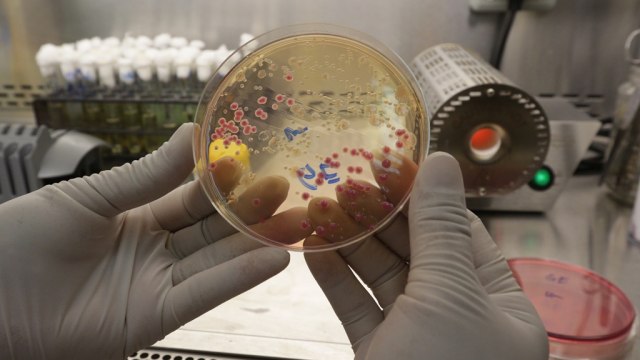 Teknisi laboratorium menunjukan sample bakteri. (Foto: Aditia Noviansyah/kumparan)