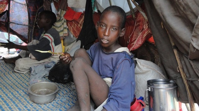 Wajah kelaparan di Somalia. (Foto: Dok. relawan ACT)