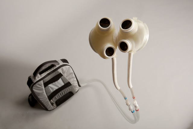 Jantung buatan, mengembalikan detak kehidupan