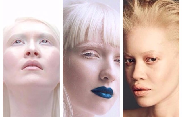 3 model albino. (Foto: conniechiu.com & Instagram)