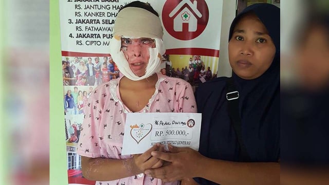 Dwi Ayu Mistina (Foto: Instagram/@komunitas_peduli_generasi)