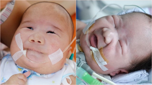 Adam Fabumi, bayi penderita Trisomy 13 (Foto: Instagram/ @adamfabumi)