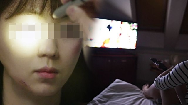 Seorang Wanita Hampir Buta setelah Marathon Drama Korea Seharian (2)