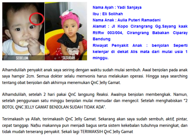 Obat Kanker Otak Tanpa Operasi (3)