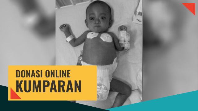 Donasi online untuk Bayi Mishalova (Foto: Muhammad Faisal Nu'man/kumparan)