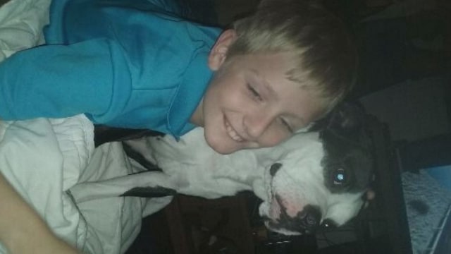 Wesley Smith menderita luka bakar. (Foto: Dok. WBTV Charlotte via Dose.com)