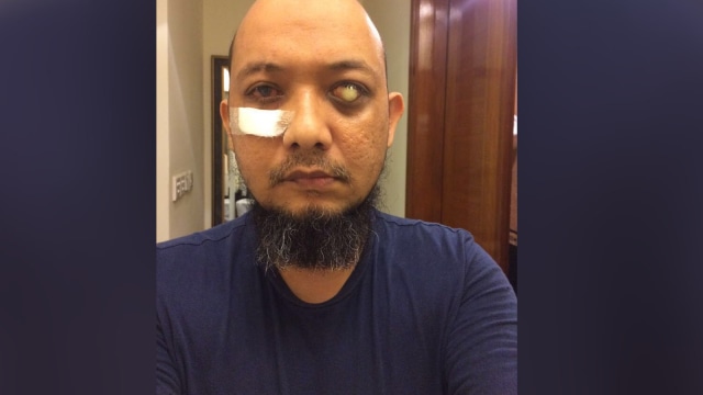 Kondisi Terkini Novel Baswedan (Foto: Dok. Keluarga Novel Baswedan)
