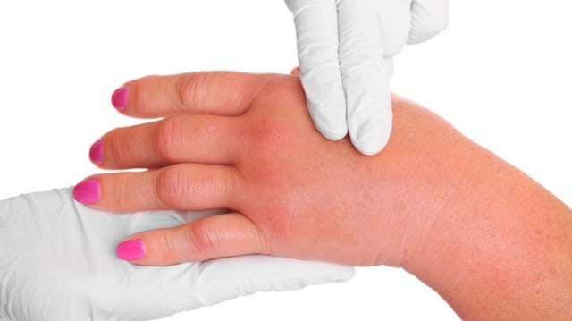 Penyebab Kesemutan Yang Sebenarnya Menurut Dokter Ahli