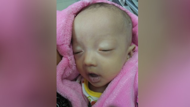Debora meninggal di RS Mitra Keluarga Kalideres (Foto: Facebook/Birgaldo Sinaga)