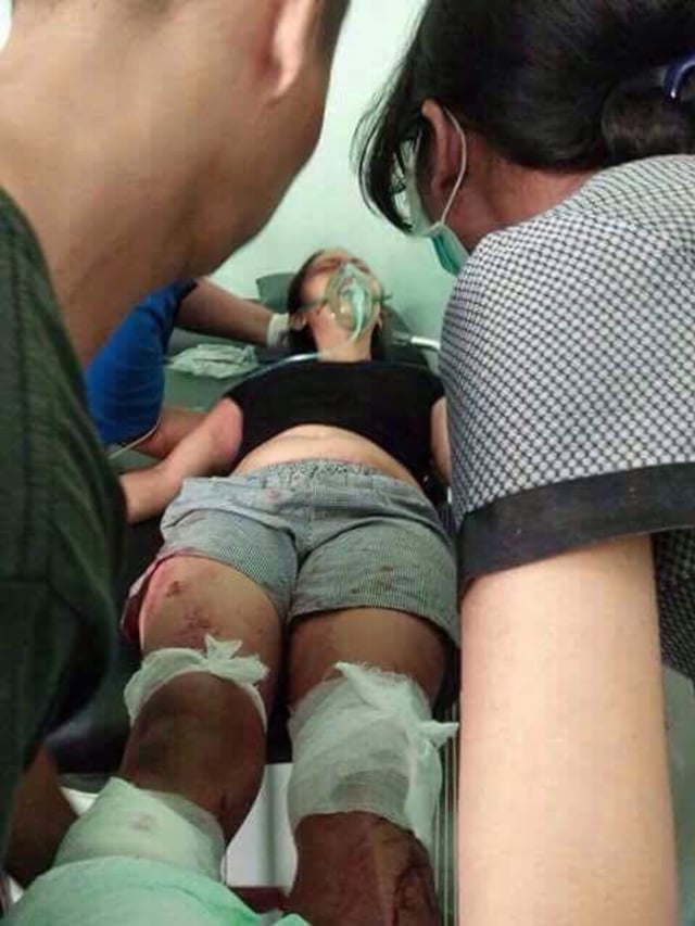 Suami Potong Kaki Istri. (Foto: Dok. kitabisa.com)