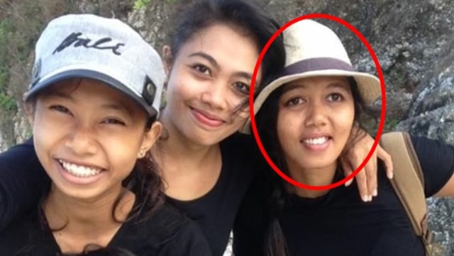 Ni Putu K. (kanan) korban suami potong kaki istri (Foto: Dok. kitabisa.com)