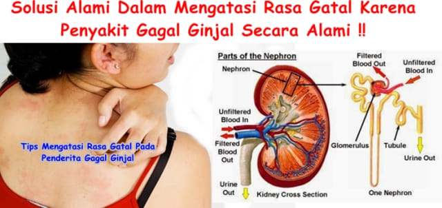 Tips Mengatasi Rasa Gatal Pada Penderita Gagal Ginjal 