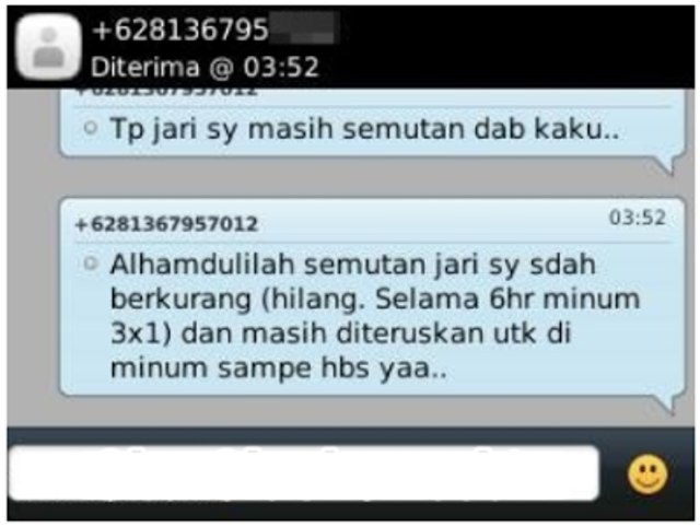 13 Penyebab Jari Tangan Kesemutan Terus-menerus (2)