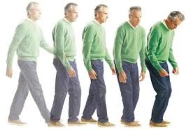 Obat Parkinson Paling Ampuh
