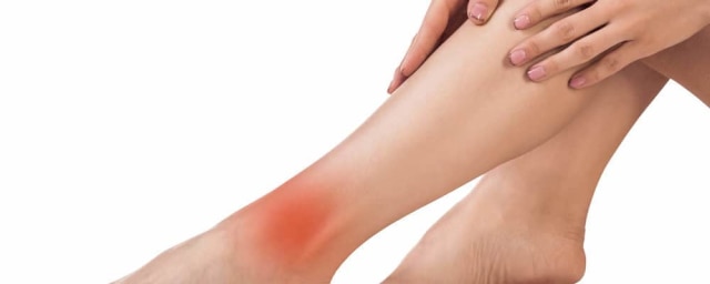 Obat Tromboflebitis