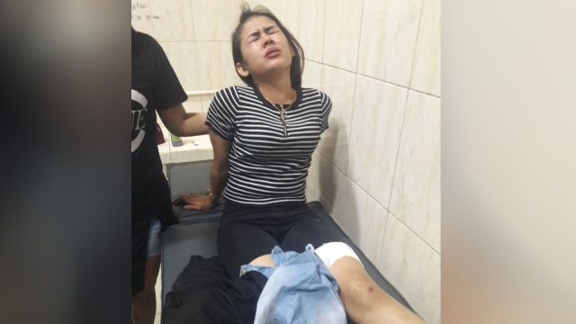 Pemandu Karaoke terkena peluru nyasar di Garut. (Foto: Dok. Istimewa)