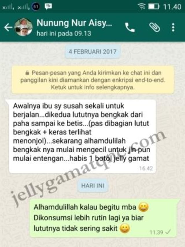 9 Cara Mengobati Patah Tulang Kaki, Tangan, Betis, Bahu Secara Alami Tanpa Operasi yg Lama (3)