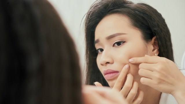 Jerawat membandel merupakan salah satu masalah kulit yang ditemui usai melahirkan. Foto: Thinkstock