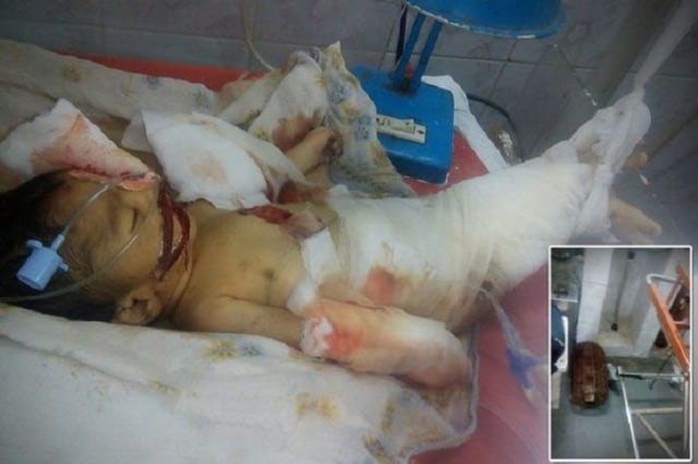  Bayi Berumur 10 Hari Tewas Dibunuh Tikus Saat Dirawat Di Rumah Sakit