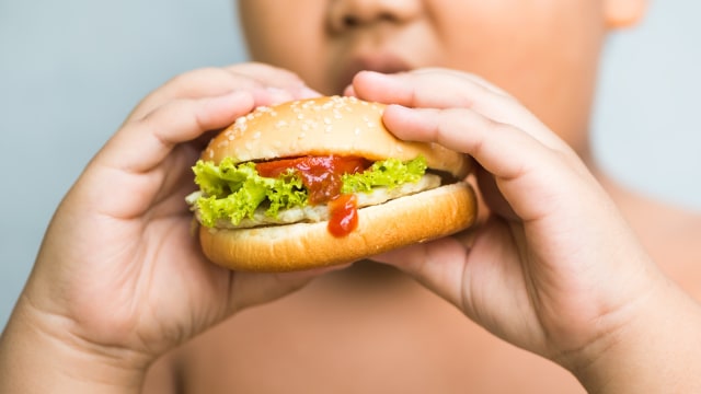 Ilustrasi anak obesitas. Foto: Shutterstock