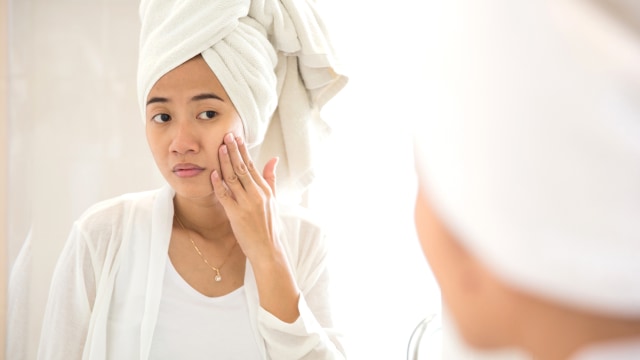 Ilustrasi adanya flek hitam di wajah Foto: Thinkstock