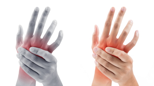 Cedera jari. (Foto: Thinkstock)