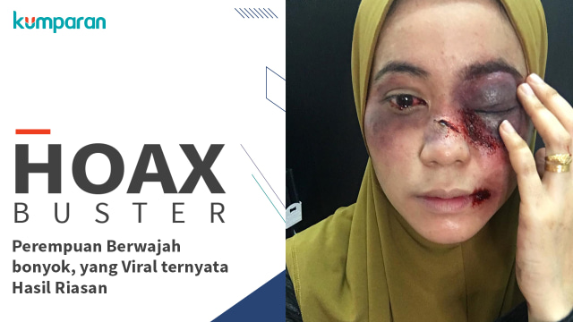 Hoax Buster (Foto: Instagram)