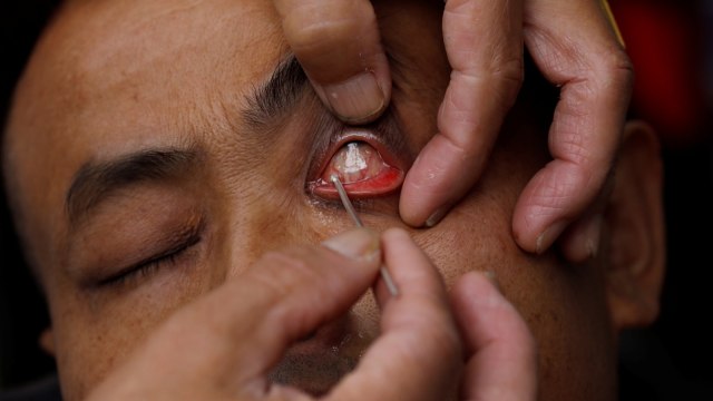 Mencukur dan membersihkan mata di China (Foto: Reuters/Tyrone Siu)