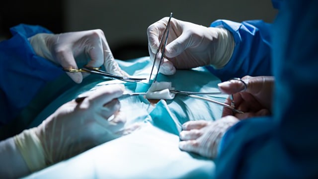 Ilustrasi operasi otak. (Foto: Freepik)