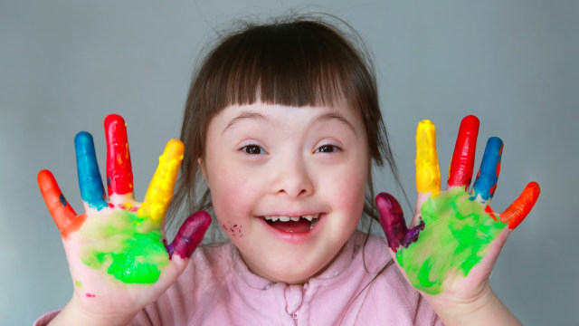 Menghadapi anak dengan down syndrome  (Foto: Thinstock)