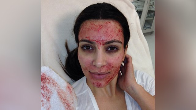 Facial darah Kim Kardashian. (Foto: Twitter/@KimKardashian)