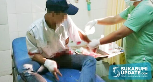 Siswa Diserang Hingga Jari Putus, BP3 Bakal Panggil Kepsek SMK Dwi Darma Sukabumi