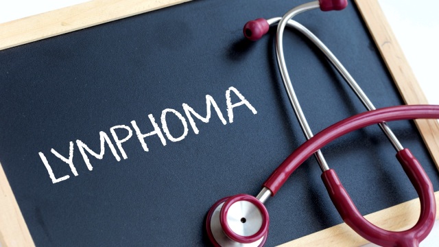 Limfoma hodgkin. (Foto: Thinkstock)